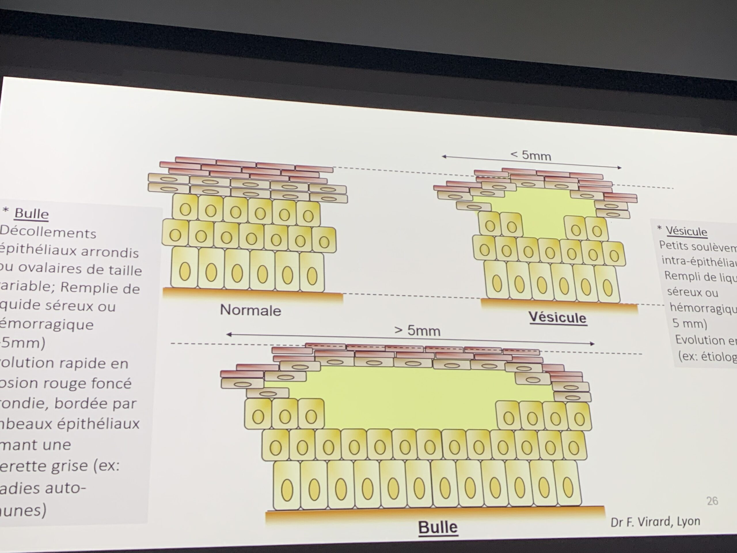 0Eg5aYvqSUWOz+StjMfq%w