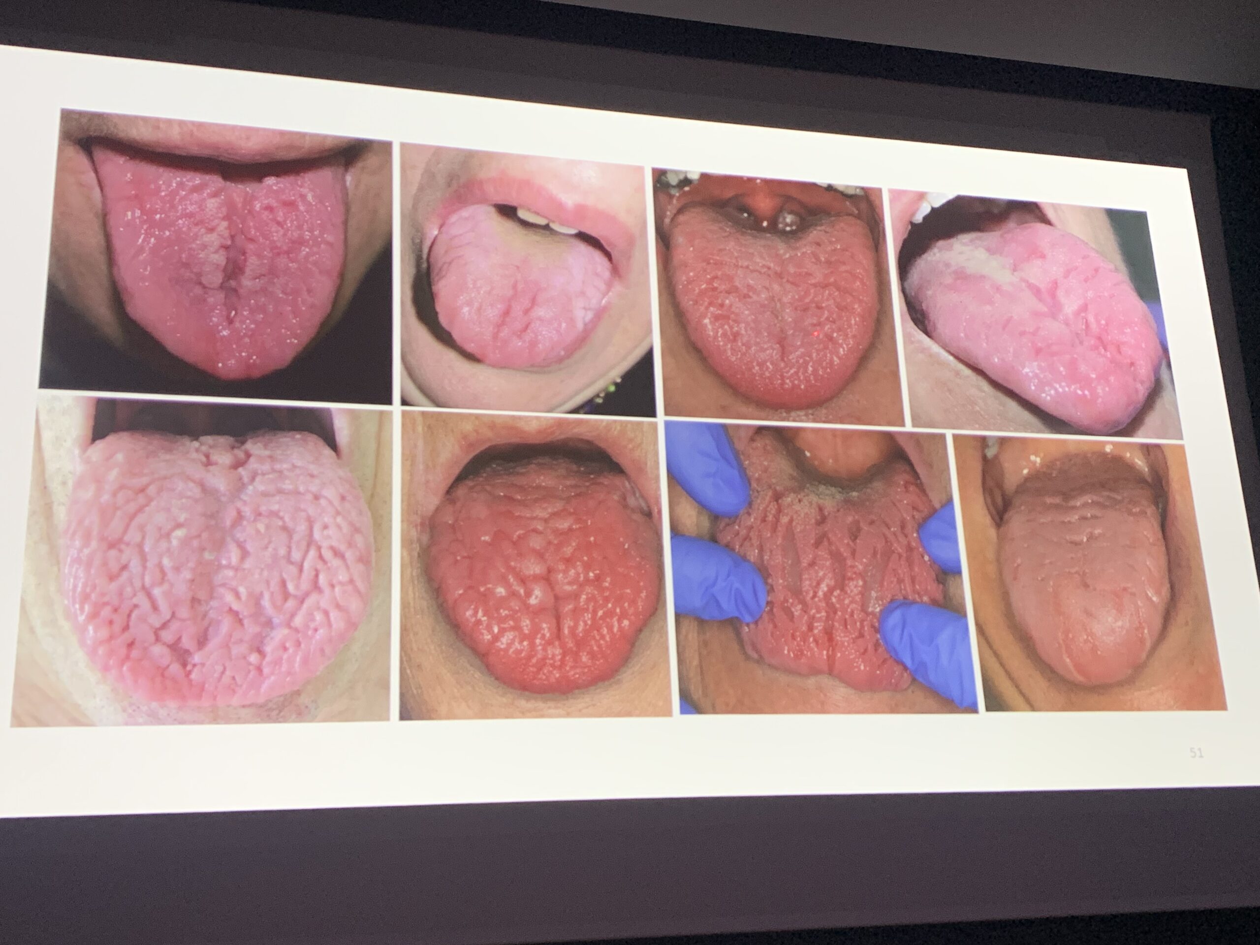 2YaXFwH8R9C1+ii6gWVQ7A