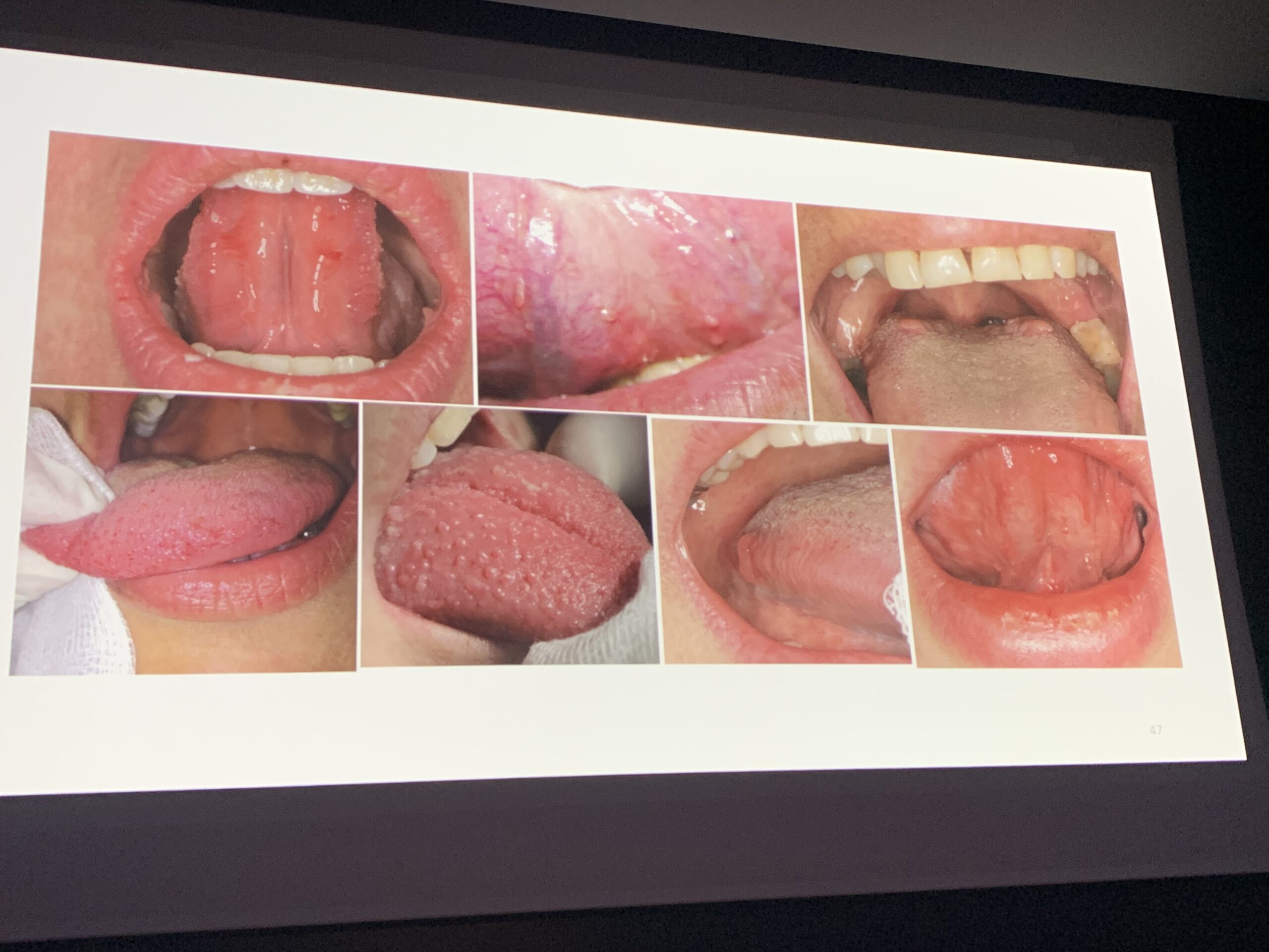 MT7plB61TvidhbsAwX+EqQ