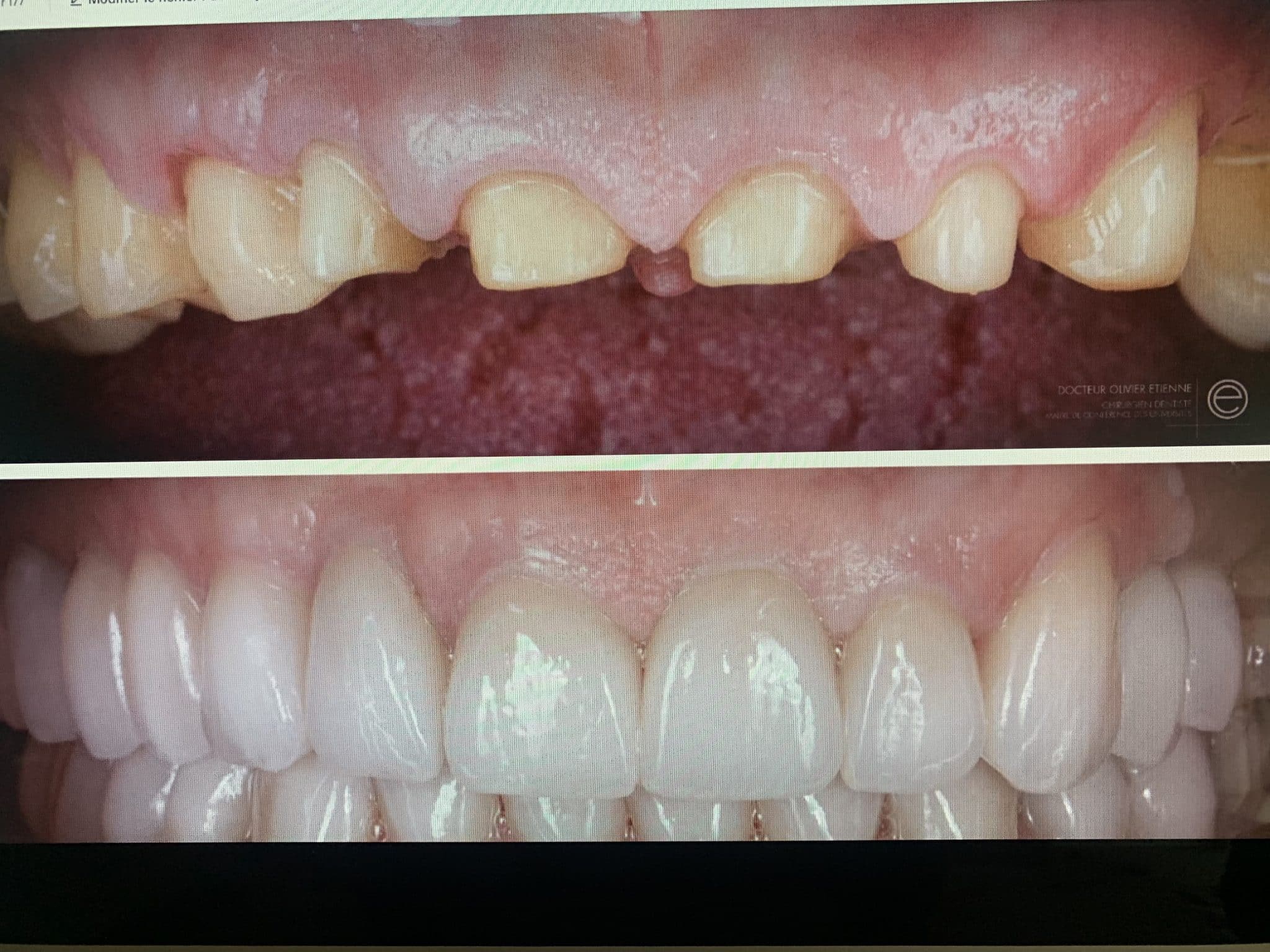 Ke2ptNPVQmGOhPweVTyW3A