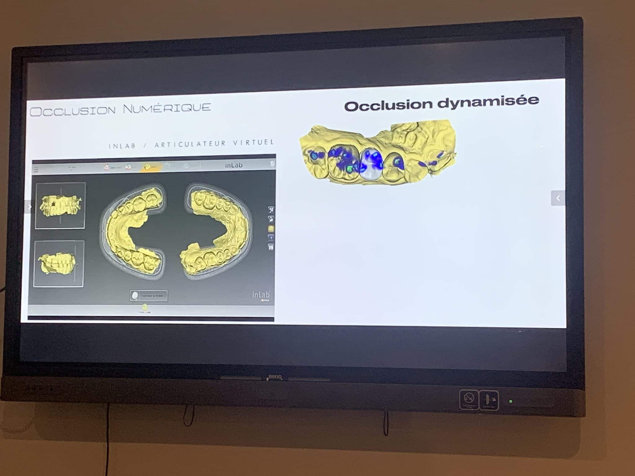 FfHoWFFLQ1aNAHAXkmn+eg