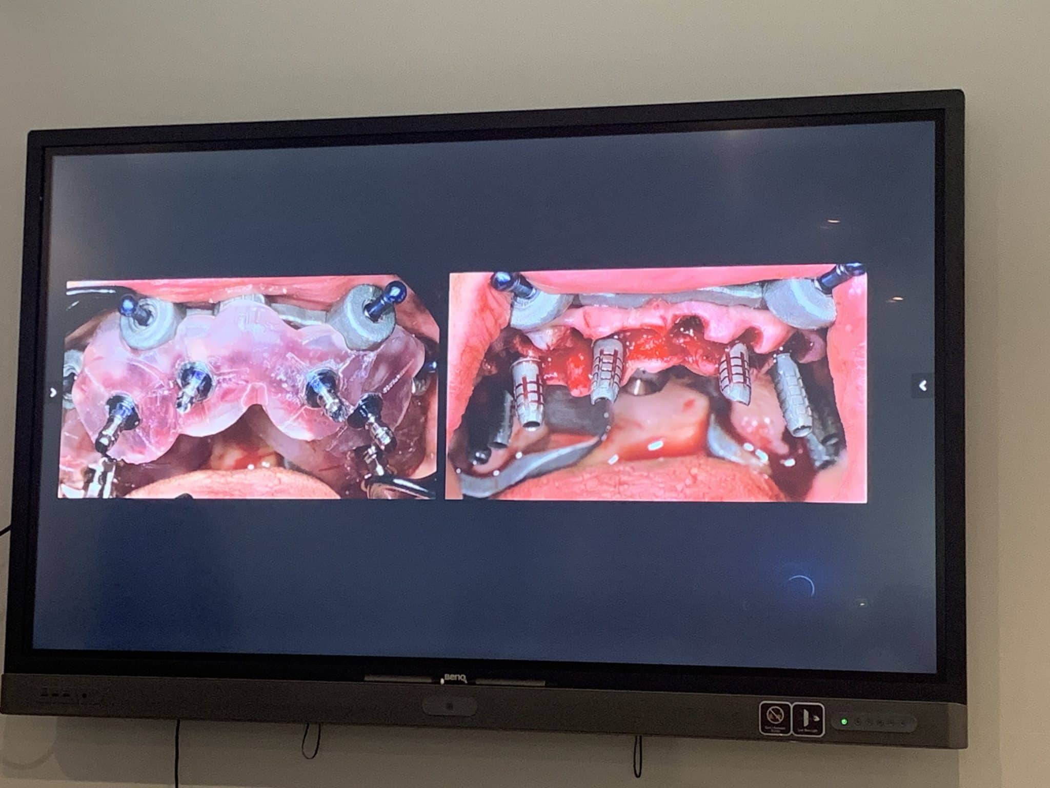 gXgarwe9Spm4r9fQGZGQSA