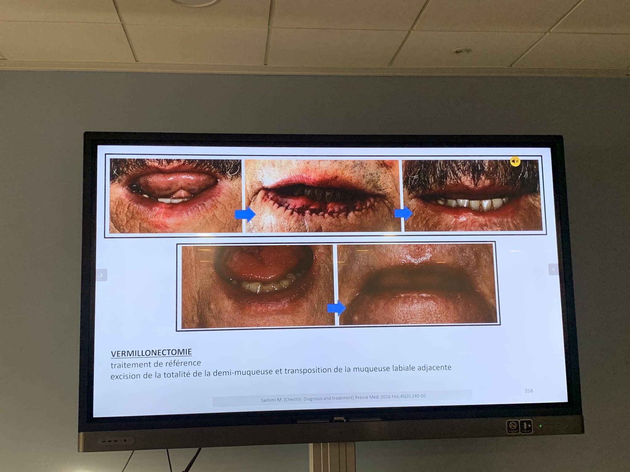 DIwSF9tgQSC0jPVUhiVOsQ