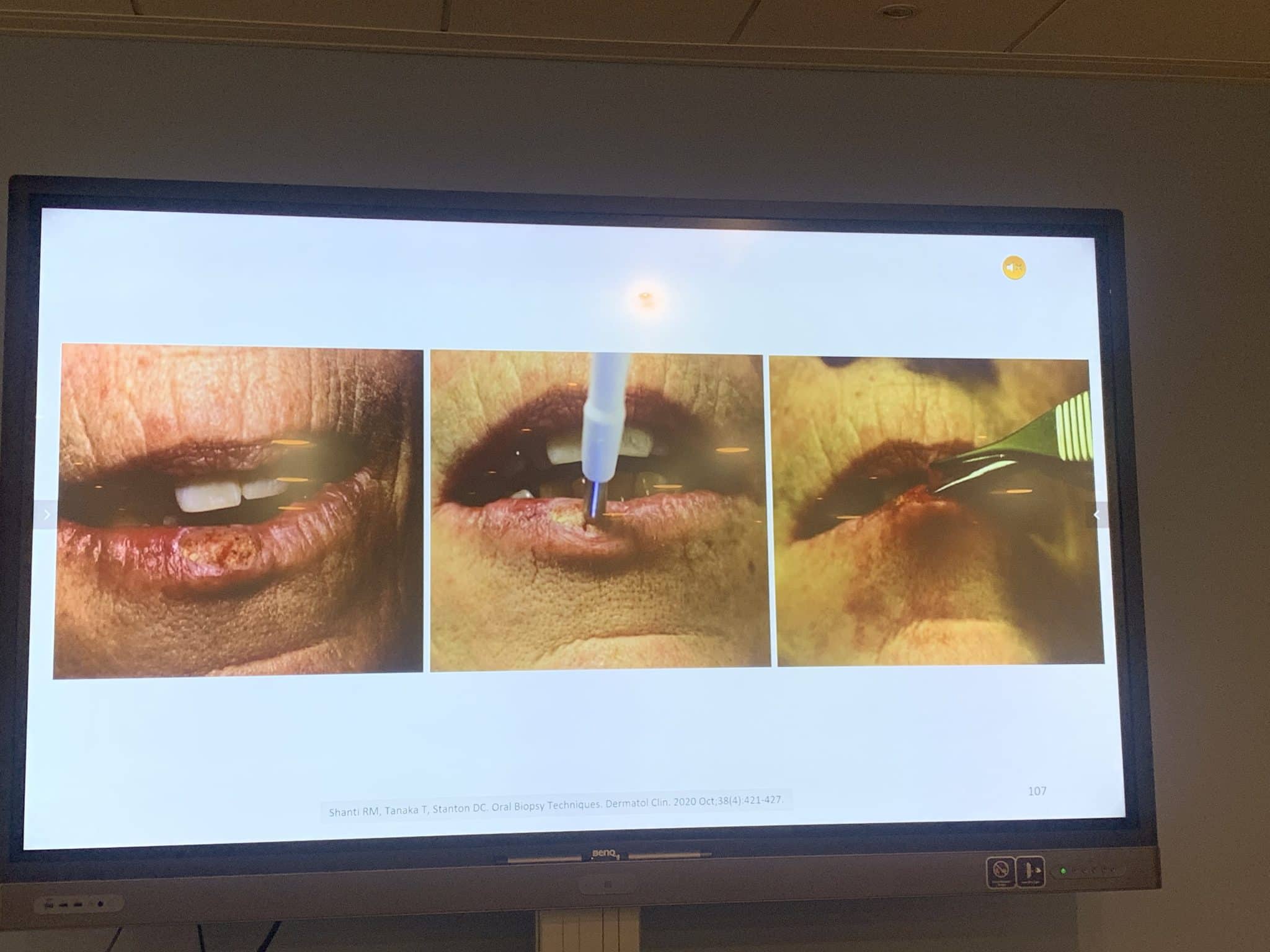 Ng2H2cZDQ+iSIH5gfDmxVg