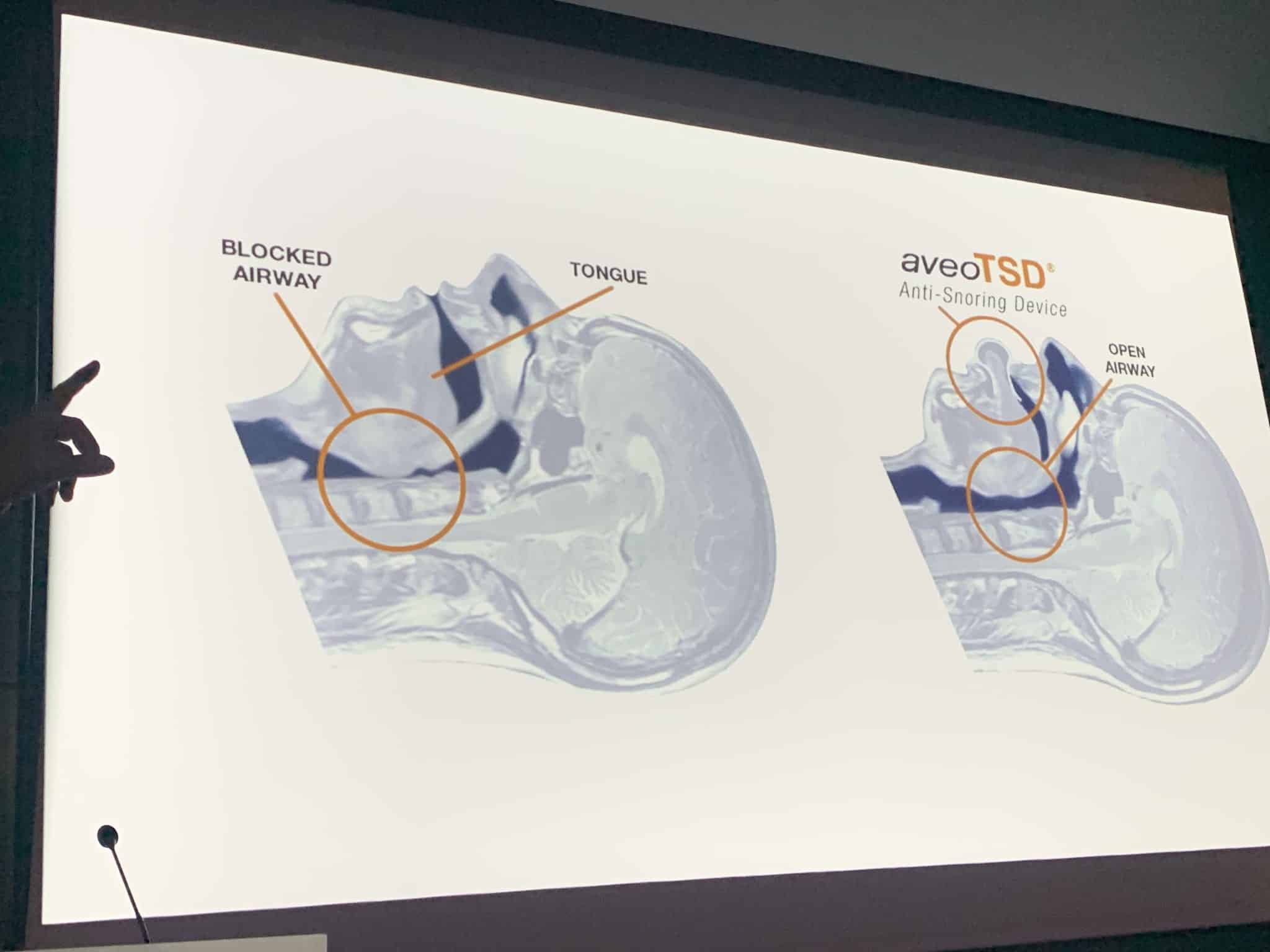 PBwDMRzkSQeP25BZhPWqIw