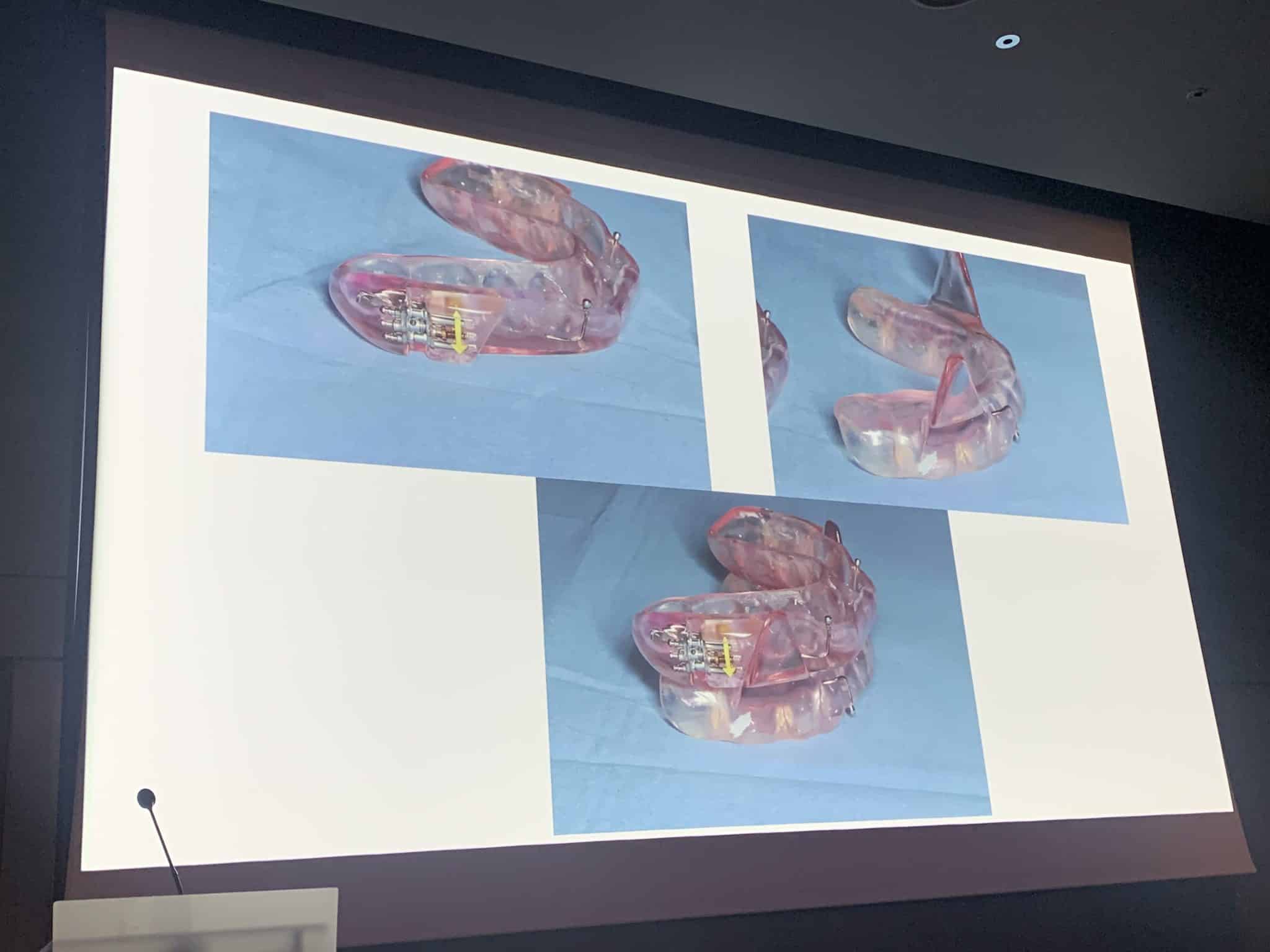 mpeeOZ1hQdSqa1PKplkW+g