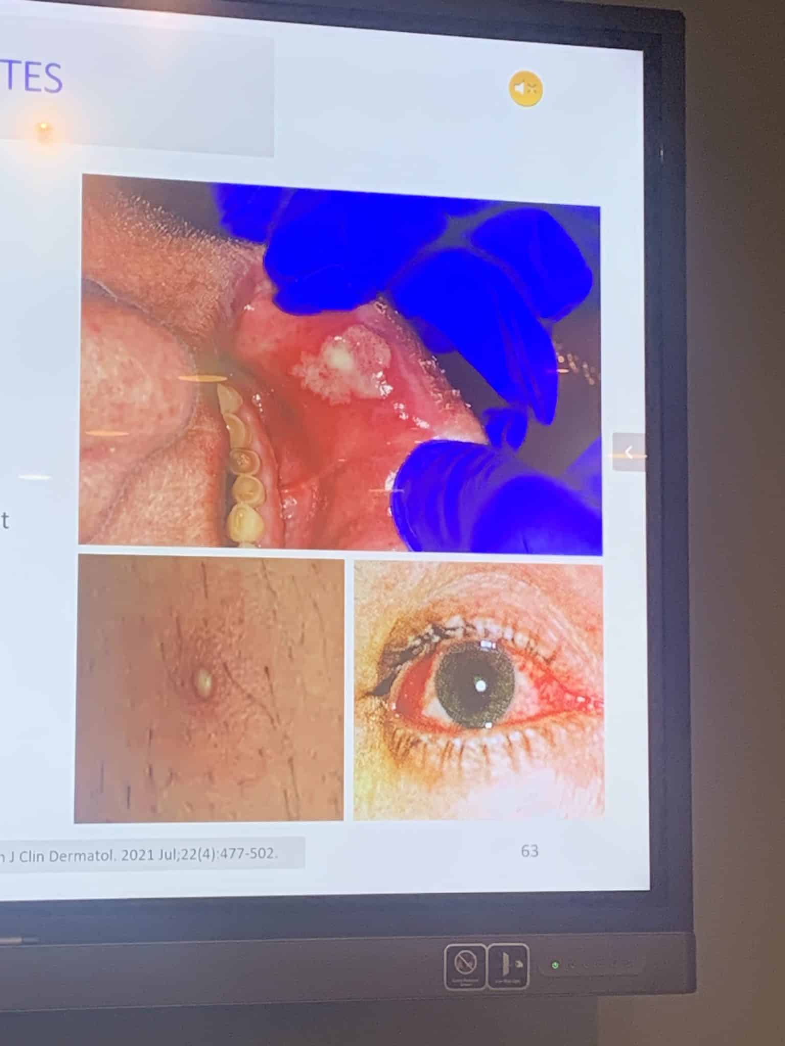 zHspalOiThKyvrEawVfdVA