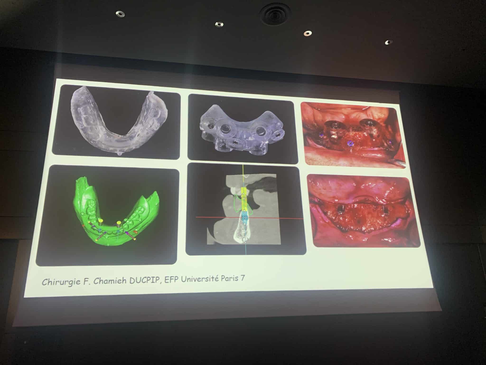 zsOXdF6aTlKMuSuiH5BWbQ