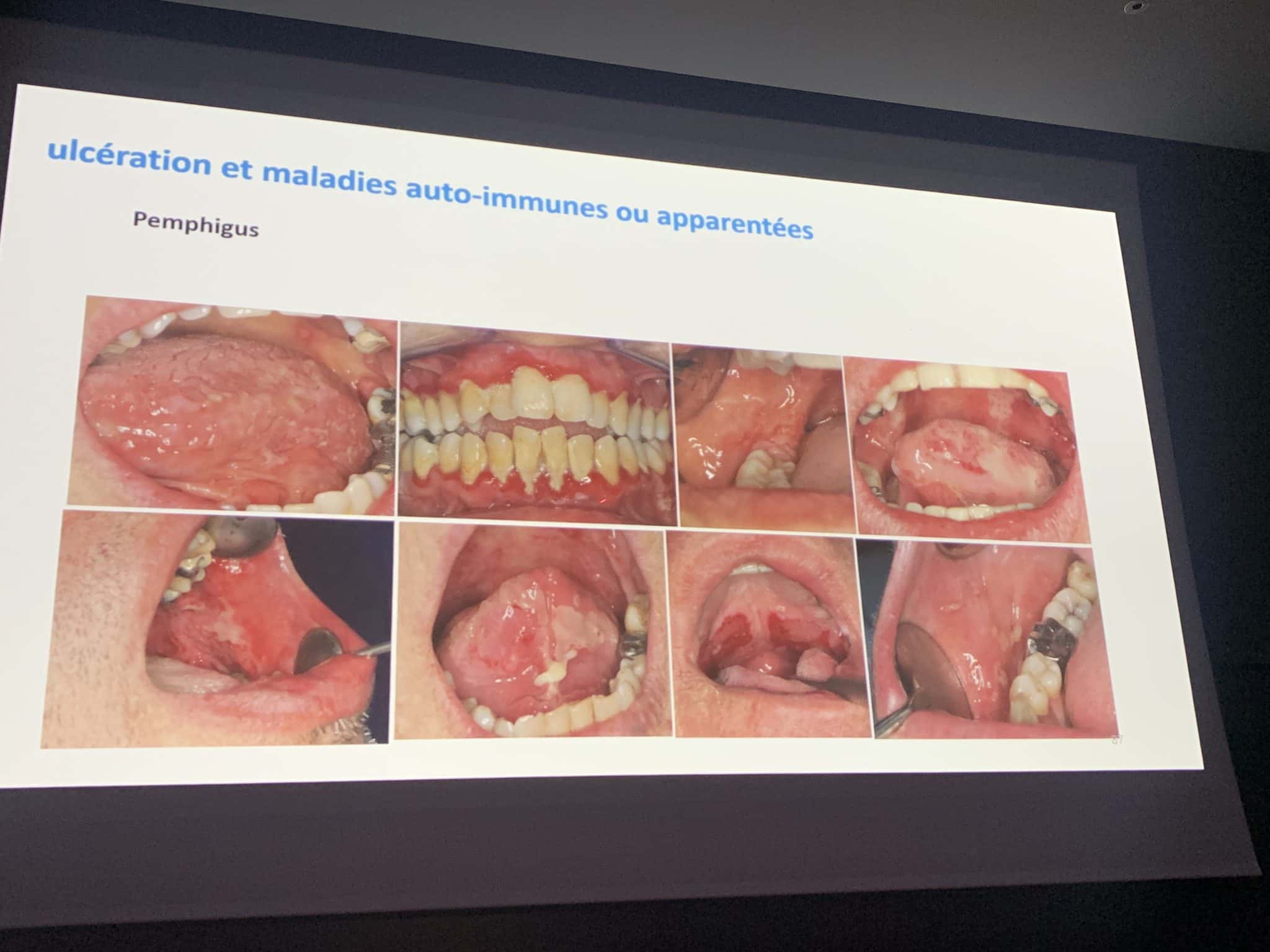 Oear4Lr4SBiXBuGcg3BQfA